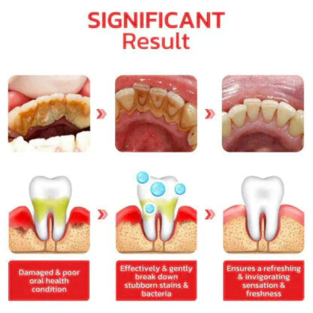 SmileBright™ Probiotic Ultra Whitening Toothpaste (Pack of 2)