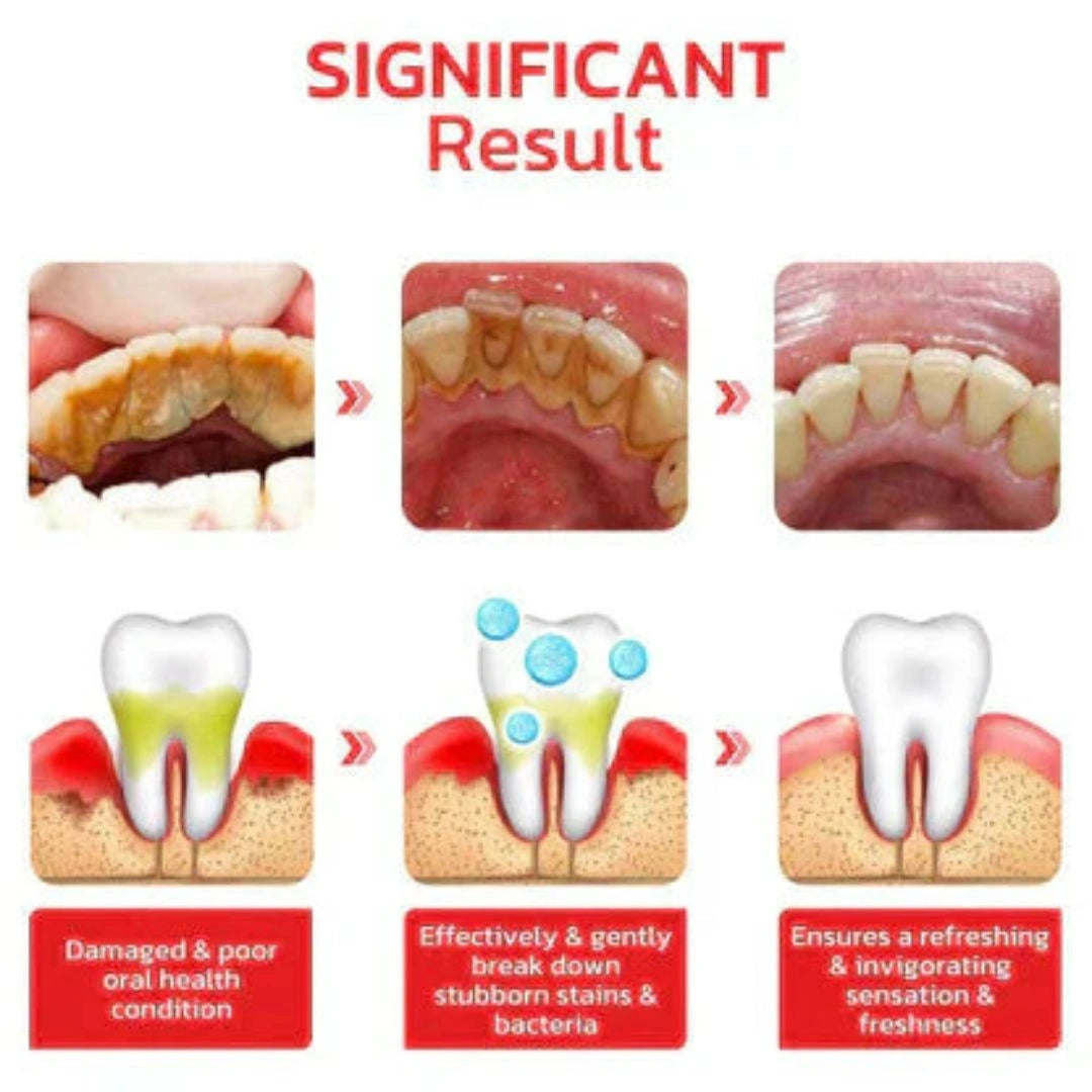 SmileBright™ Probiotic Ultra Whitening Toothpaste (Pack of 2)
